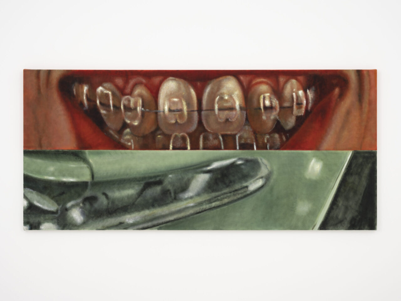 Detailreiche Darstellung eines Lächelns mit Zahnspange, unterbrochen von einem Bild eines metallischen Gegenstands.